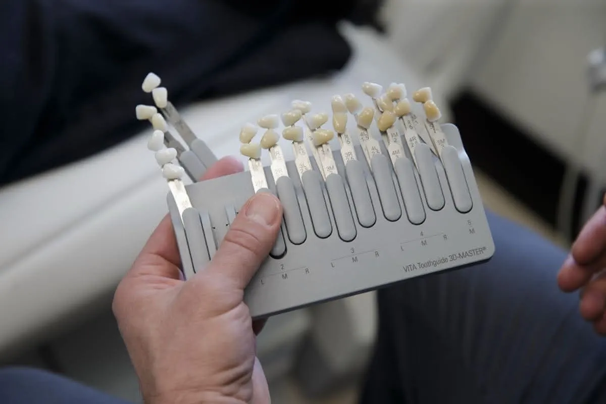 Closeup of a toothguide color tool