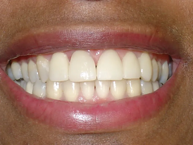 case 003 smile after photo