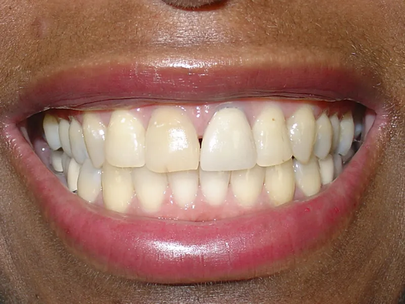 case 003 smile before photo
