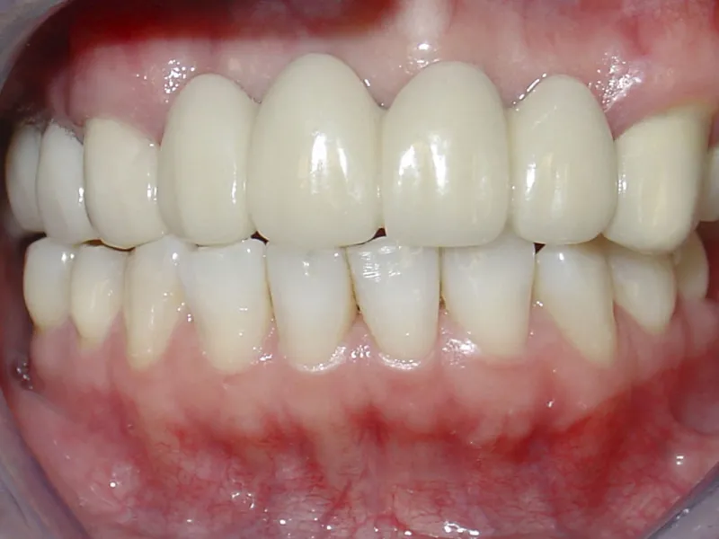 case 005 retracted after photo