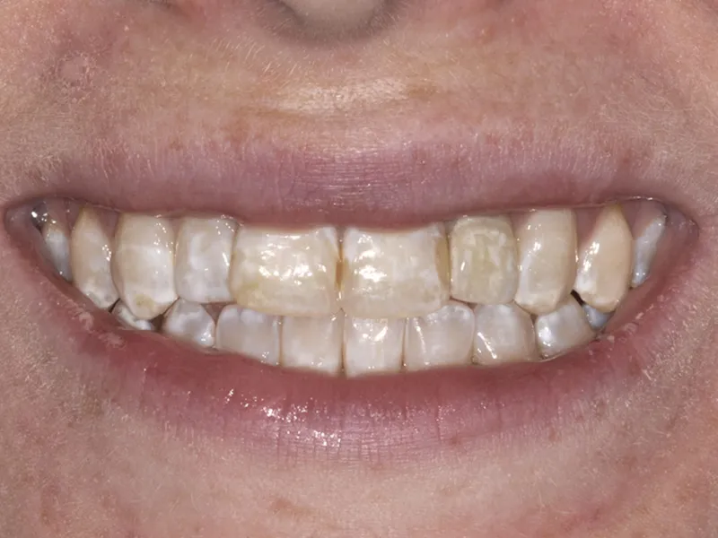 case 006 smile before photo