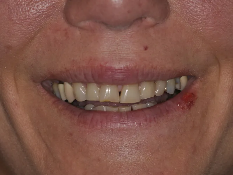 case 0106 smile before photo