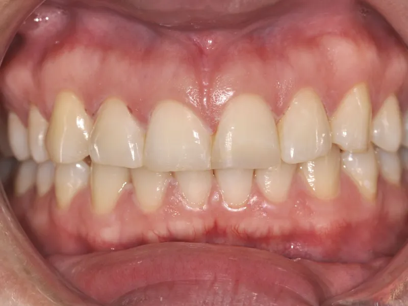 case 017 retracted after photo
