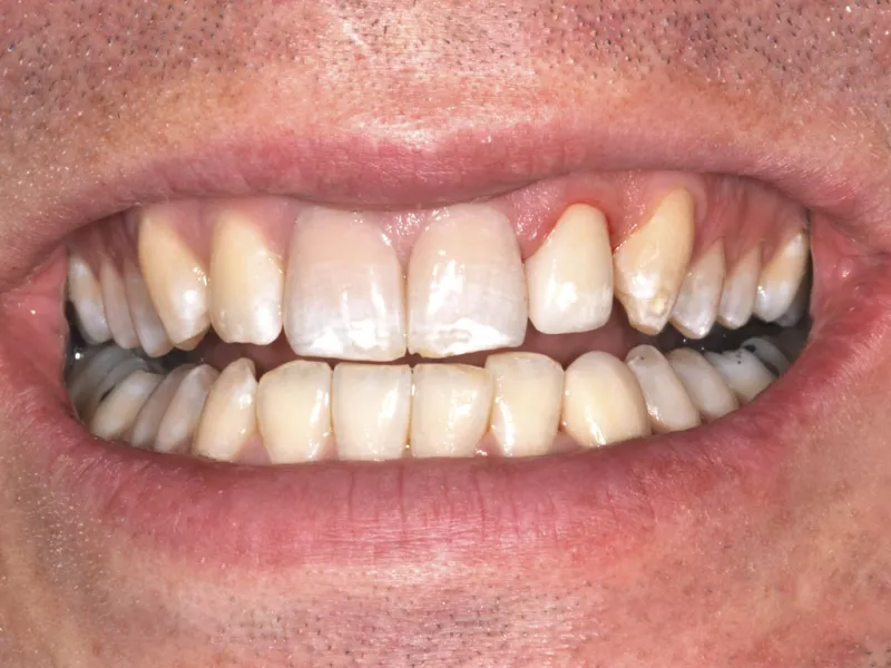 case 018 smile after photo