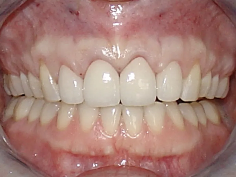 case 019 retracted after photo