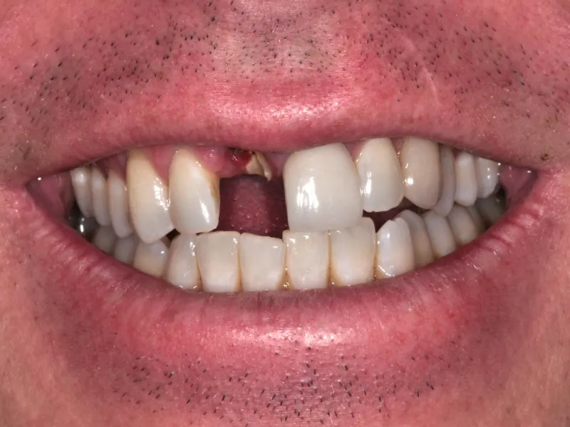 case 020 smile before photo