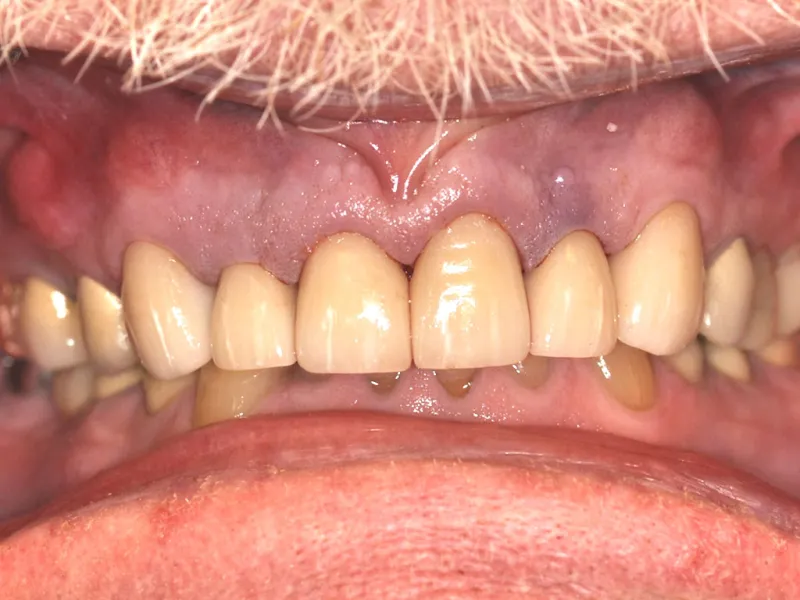 case 022 retracted after photo