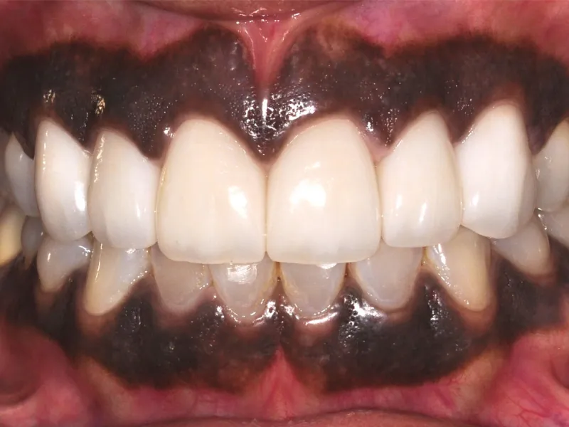 case 034 retracted after photo