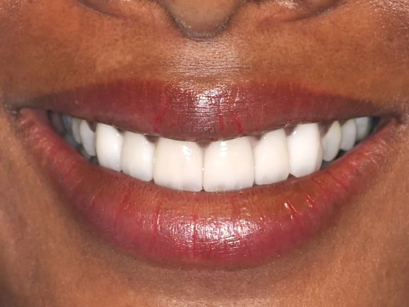 case 034 smile after photo