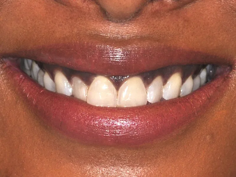 case 034 smile before photo