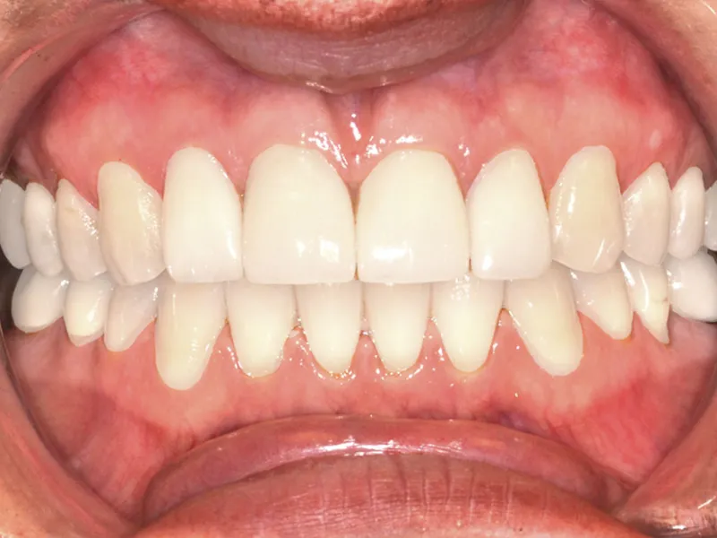 case 036 retracted after photo