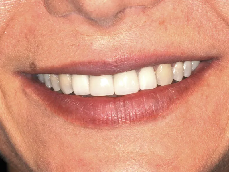 case 036 smile after photo