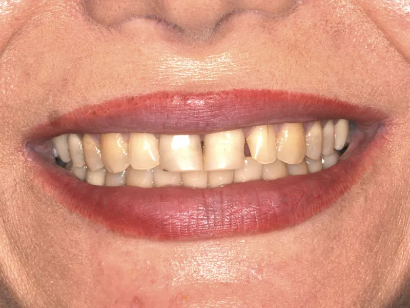 case 036 smile before photo 