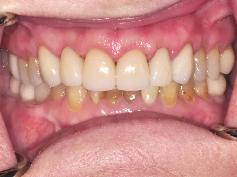 case 037 retracted after photo