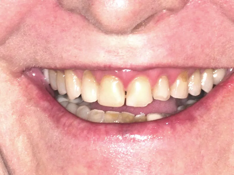 case 037 smile before photo