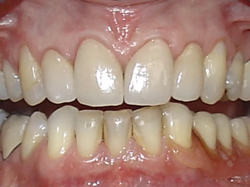 case 038 retracted after photo