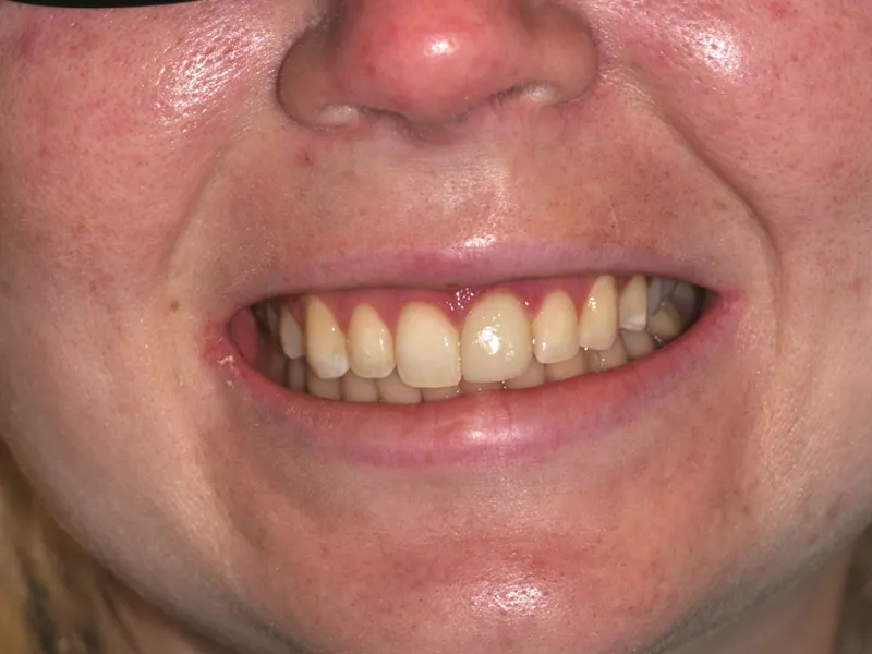 case 040 close face after photo