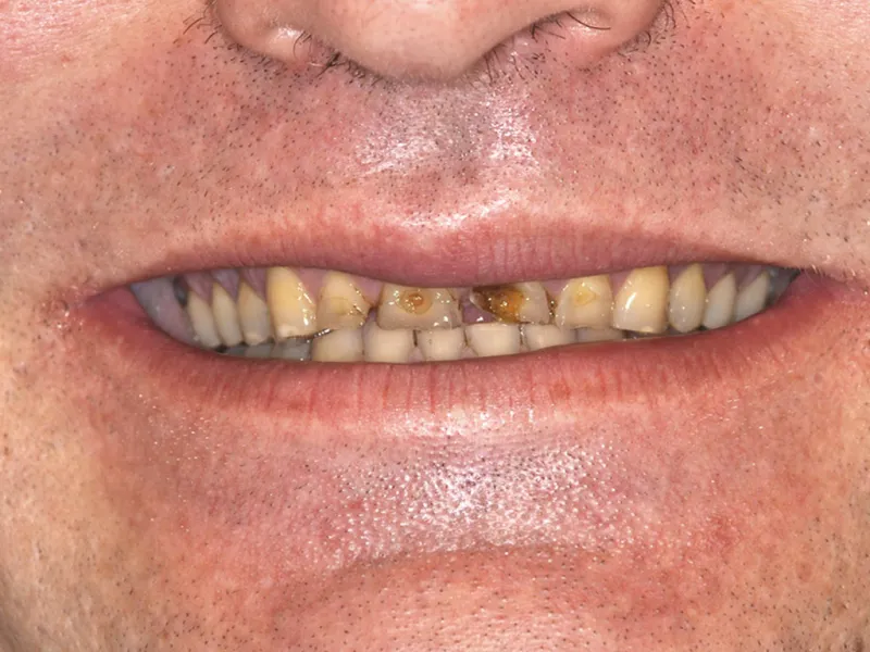 case 043 smile before photo