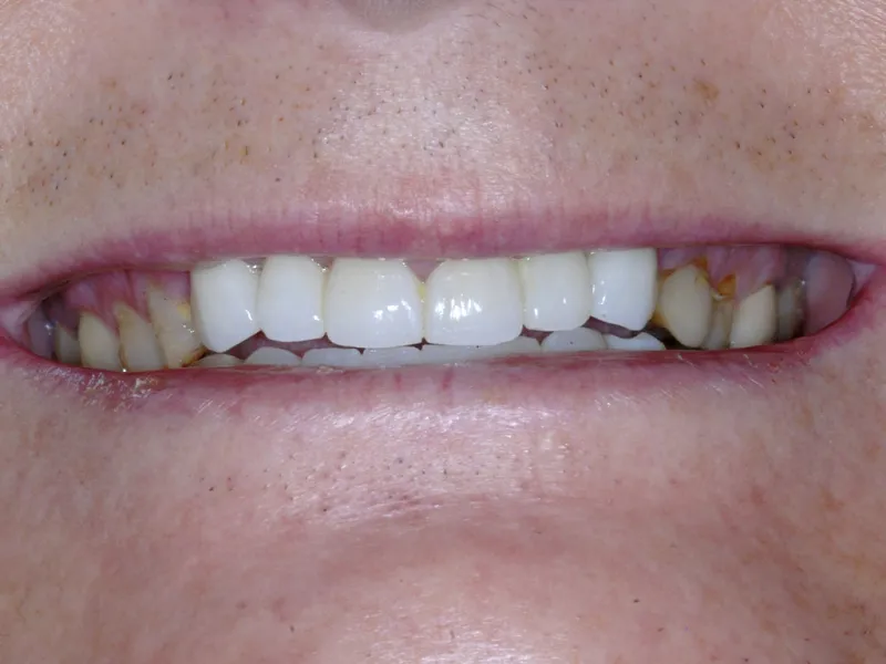 case 045 smile after photo