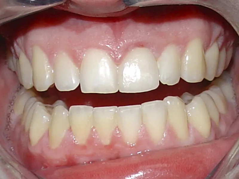 case 046 retracted after photo