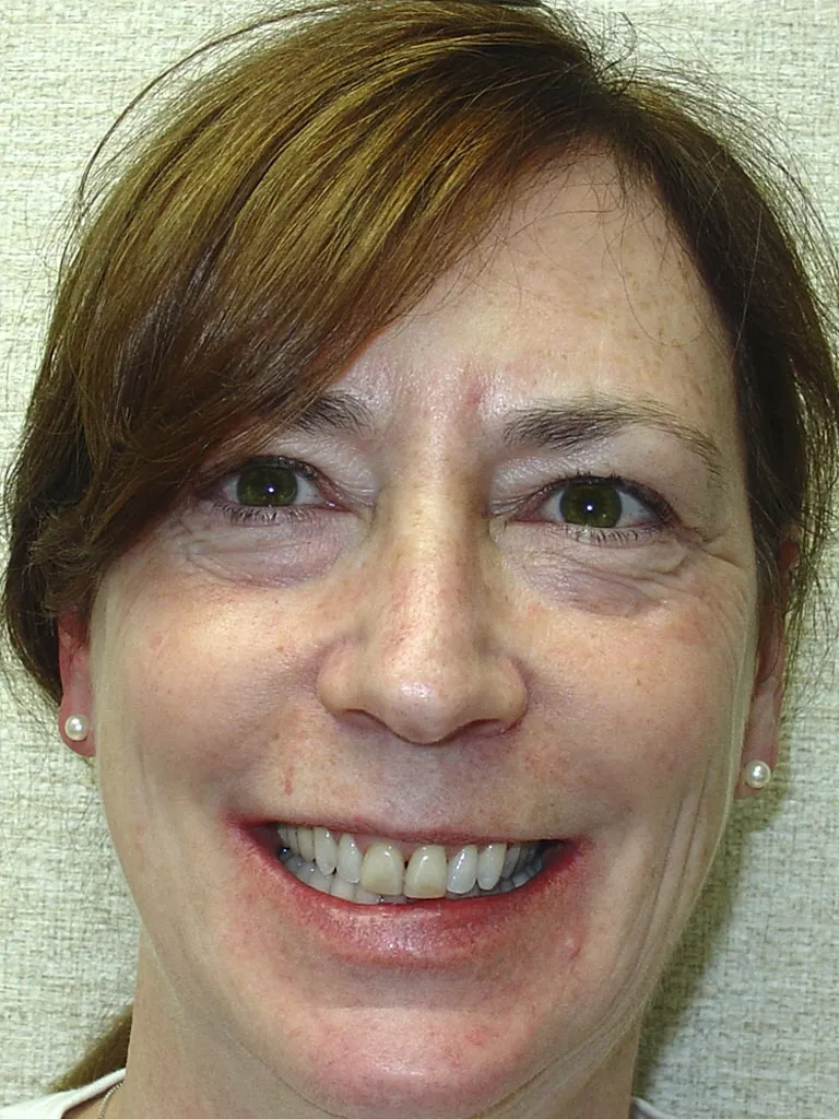case 060 portrait before photo