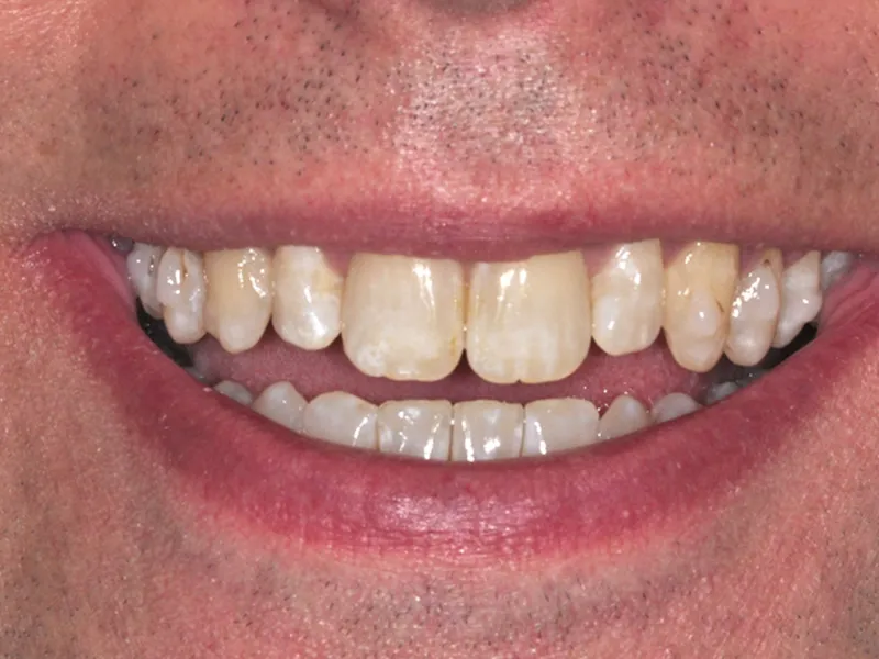 case 068 smile before photo