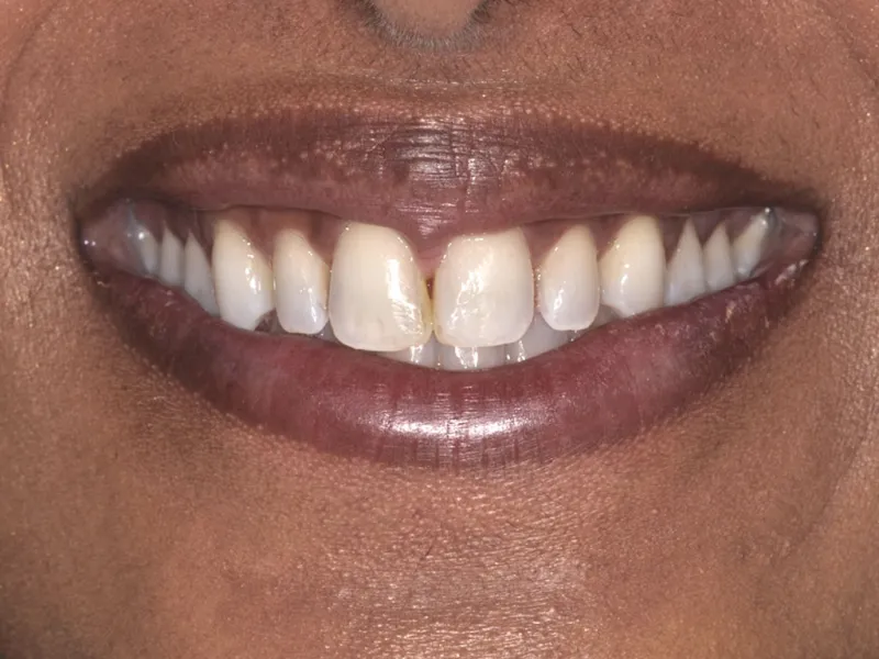 case 072 smile before photo