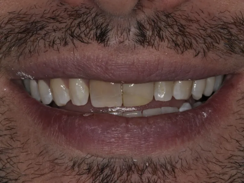 case 073 smile before photo