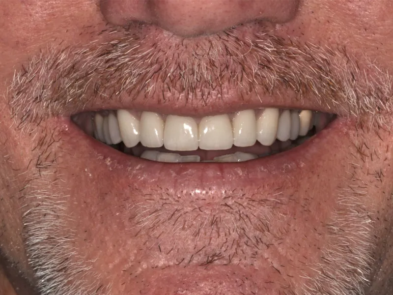 case 076 smile after photo