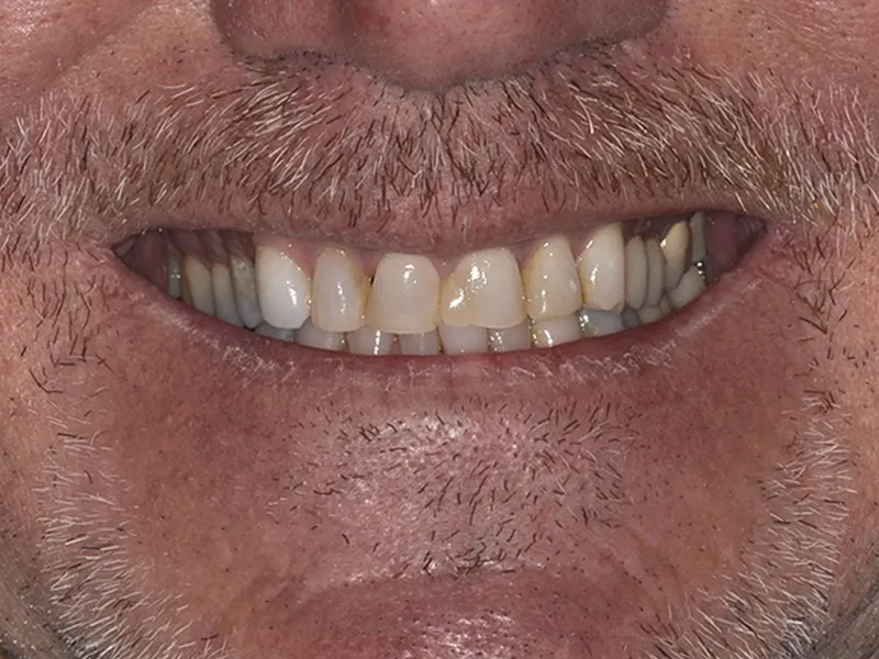 case 076 smile before photo