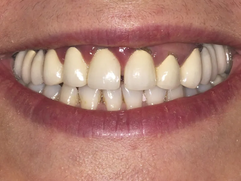 case 078 smile before photo