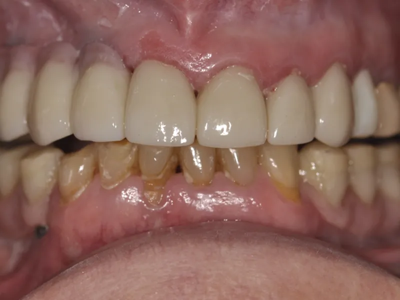 case 081 retracted after photo