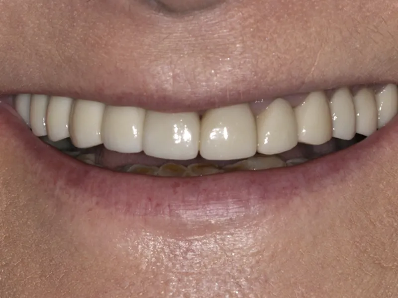 case 081 smile after photo