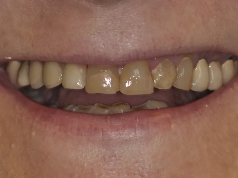 case 081 smile before photo