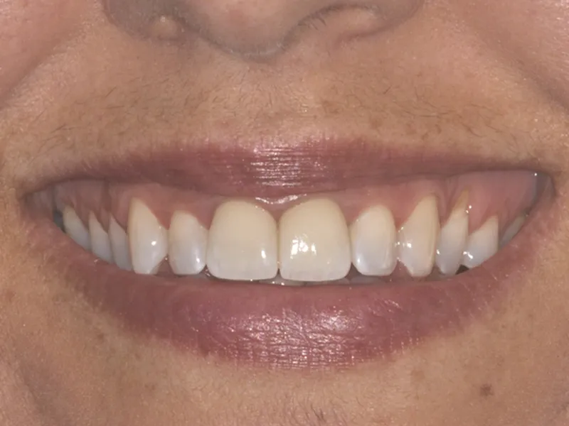 case 082 smile after photo