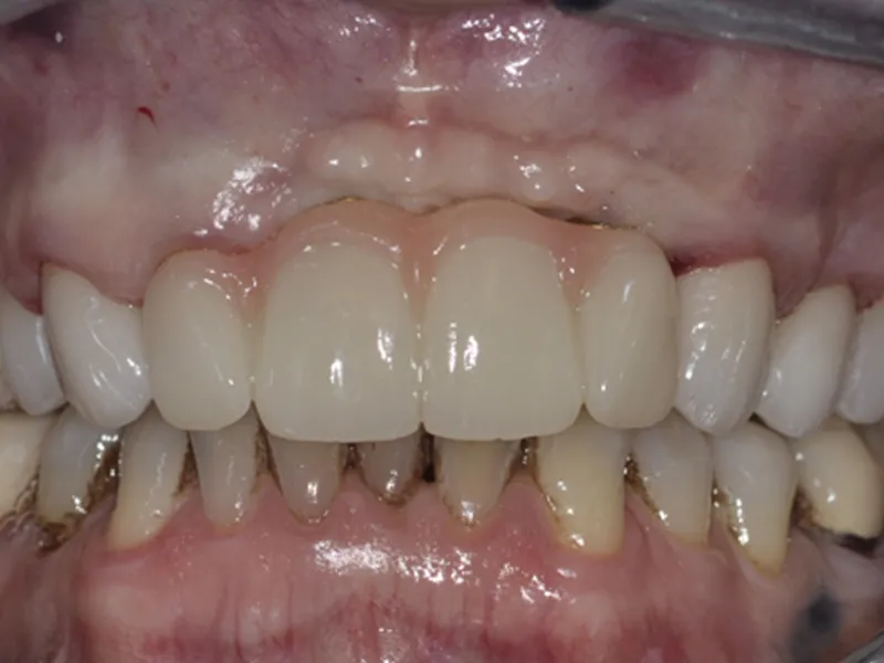 case 083 retracted after photo