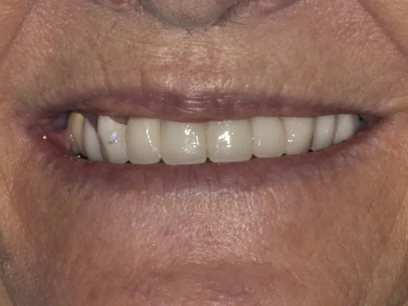 case 083 smile after photo