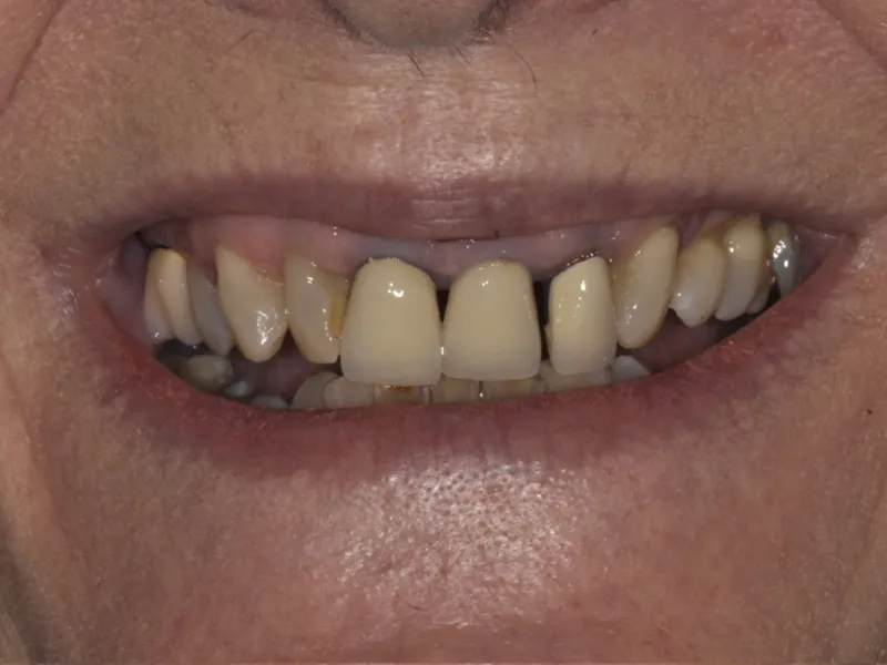 case 083 smile before photo