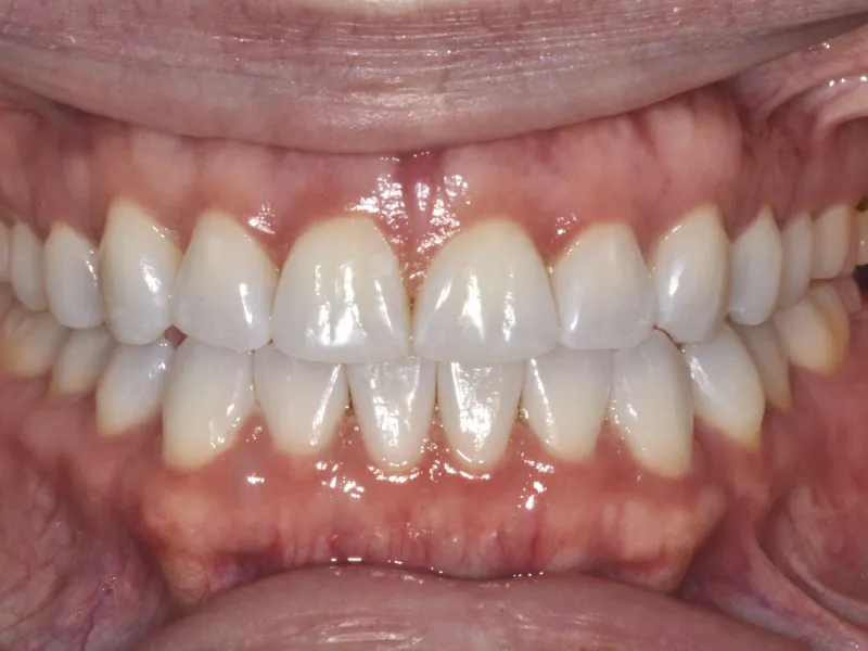case 307 retracted after photo