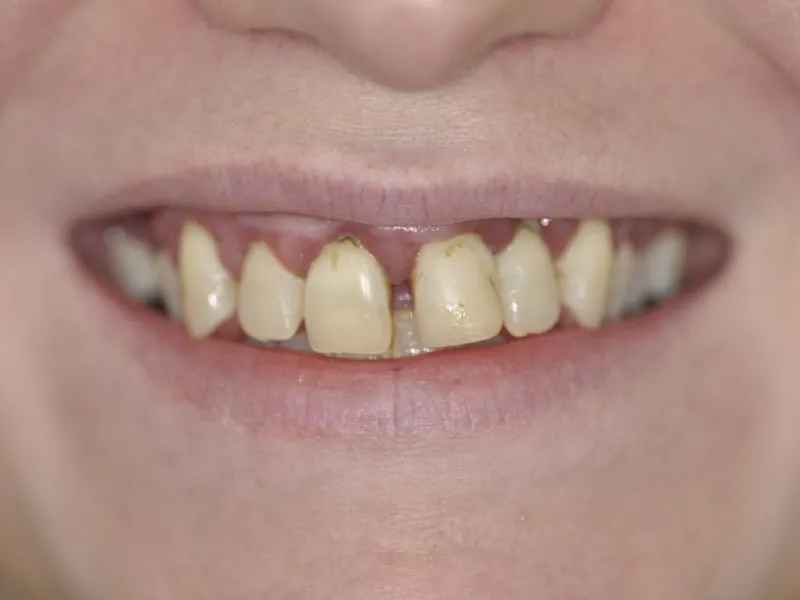case 310 smile before photo