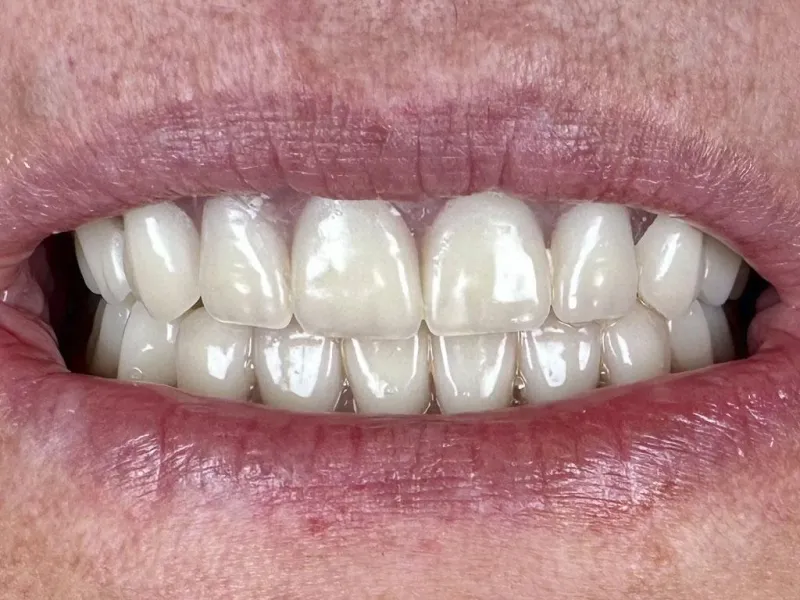 A photo of case 400 close up after