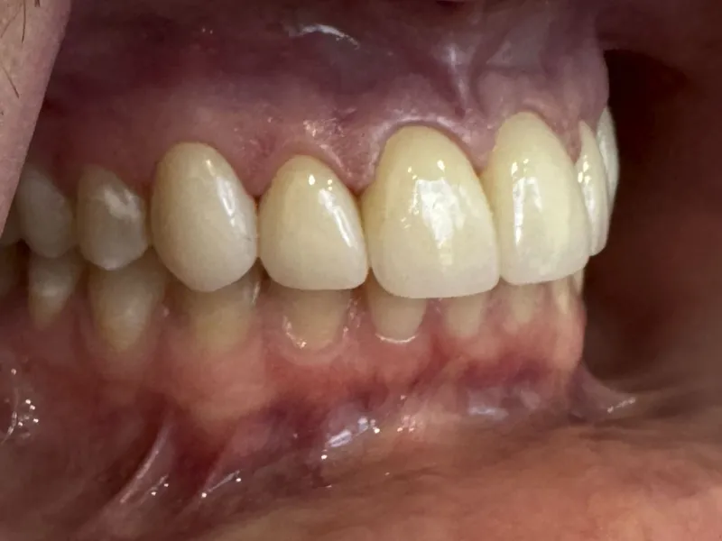 case 500 retracted right after photo