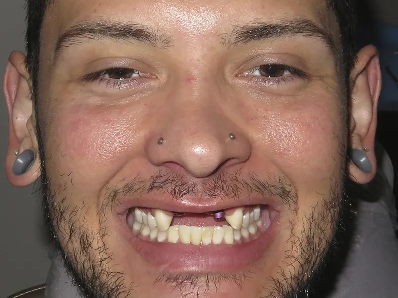 Case 601 Full Face Before photo