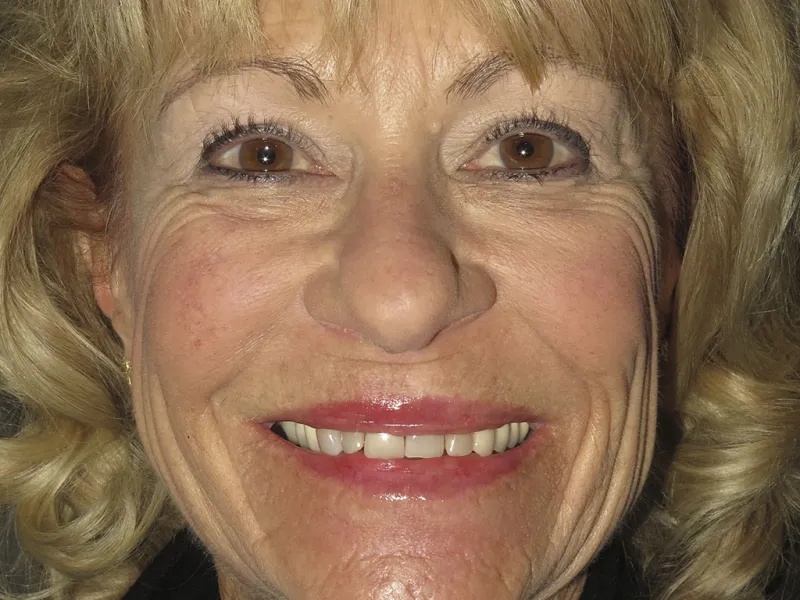 Full face before photo of Cheryl.