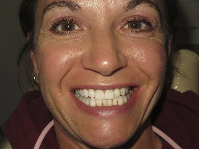 Full face after photo of Tara's smile.