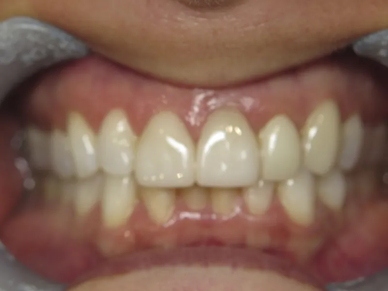 Retracted before view of Tara's smile.