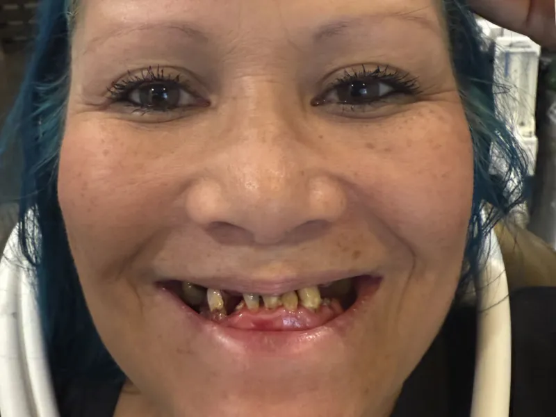 A full face smiling photo pre-extraction.